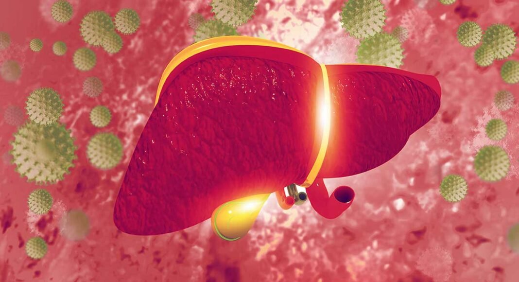 Primary biliary cirrhosis symptoms, causes and risks