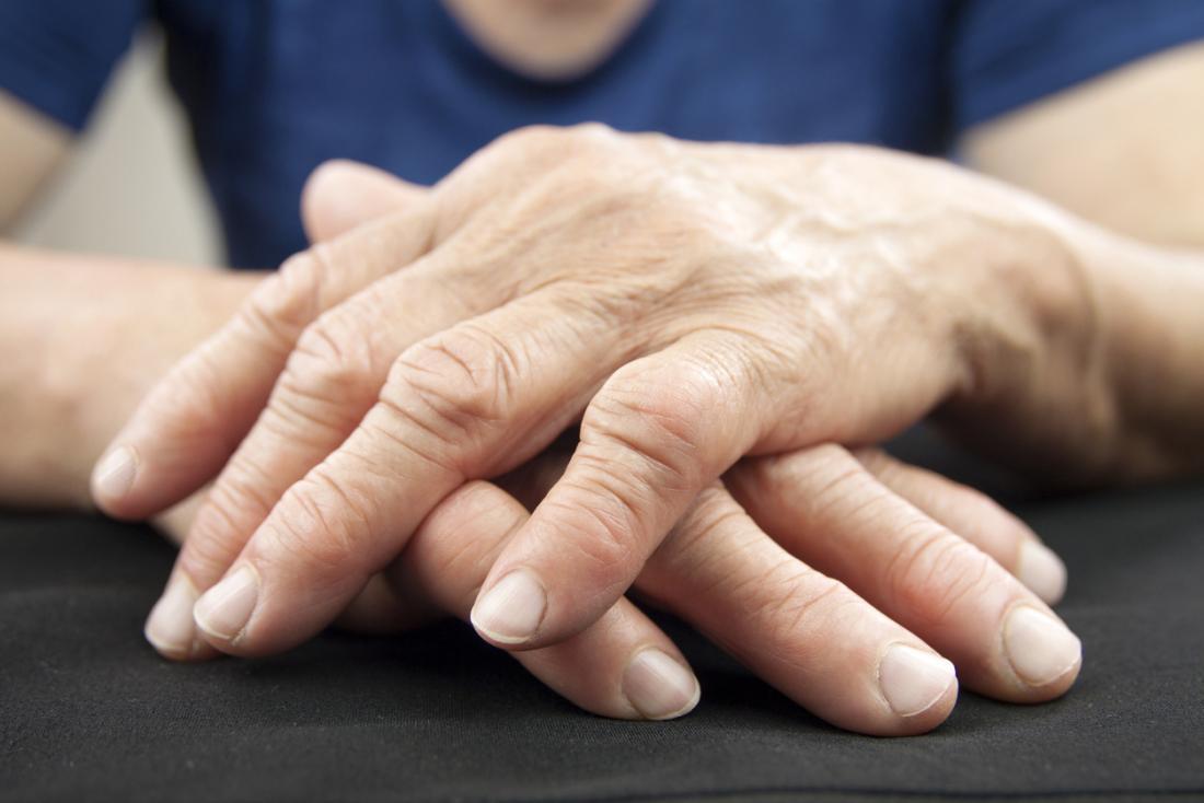 Arthritis In Hands And Feet Treatment